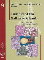 Tumors of the Salivary Glands