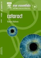 Cataract