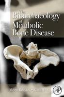 The Bioarchaeology of Metabolic Bone Disease