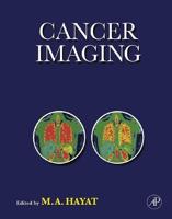 Cancer Imaging