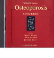 CD to Accompany Osteoporosis, 2nd Ed