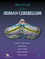 MRI Atlas of the Human Cerebellum