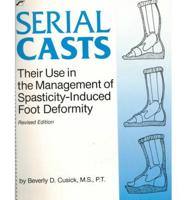 Serial Casts