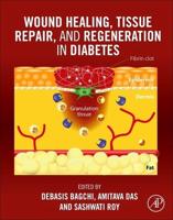 Wound Healing, Tissue Repair and Regeneration in Diabetes