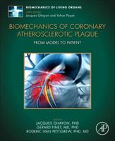 Biomechanics of Coronary Atherosclerotic Plaque: From Model to Patient
