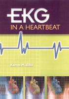 EKG in a Heartbeat
