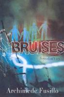 Bruises