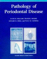 Pathology of Periodontal Disease