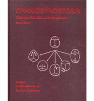 Craniosynostosis