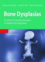 Bone Dysplasias