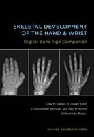 Skeletal Development of the Hand and Wrist Digital Bone Age Companion