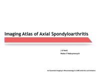 Imaging Atlas of Axial Spondyloarthritis