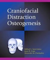Craniofacial Distraction Osteogenesis