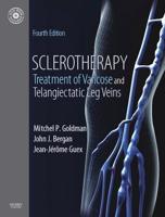 Sclerotherapy