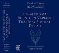 Atlas of Normal Roentgen Variants That May Simulate Disease