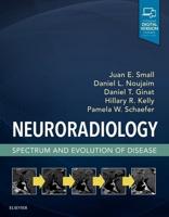 Neuroradiology