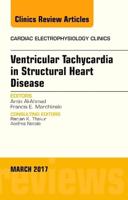 Ventricular Tachycardia in Structural Heart Disease