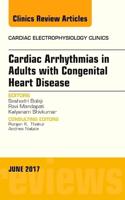 Cardiac Arrhythmias in Adults With Congenital Heart Disease
