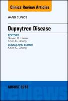 Dupuytren Disease