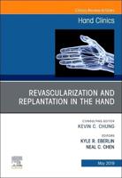 Revascularization and Replantation in the Hand