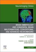 Brain Embryology and the Cause of Congenital Malformations