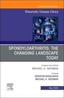 Spondyloarthritis