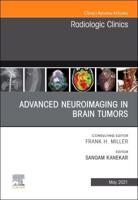 Advanced Neuroimaging in Brain Tumors