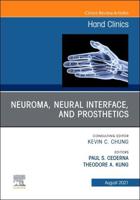 Neuroma, Neural Interface, and Prosthetics