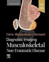 Musculoskeletal Non-Traumatic Disease