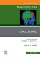 Spinal Tumors