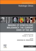 Imaging of Gynecologic Malignancy