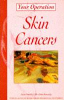 Skin Cancers