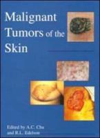 Malignant Tumors of the Skin