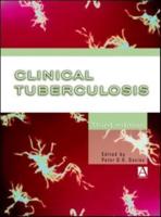 Clinical Tuberculosis