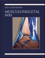 Musculoskeletal MRI