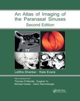 Atlas of Imaging of the Paranasal Sinuses
