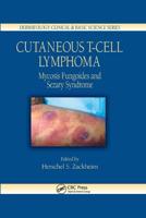 Cutaneous T-Cell Lymphoma