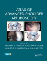 Atlas of Advanced Shoulder Arthroscopy