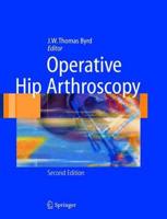 Operative Hip Arthroscopy