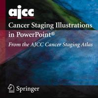 AJCC Cancer Staging Illustrations in PowerPoint®