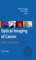 Optical Imaging of Cancer