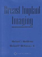 Breast Implant Imaging