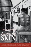 Acres of Skin : Human Experiments at Holmesburg Prison