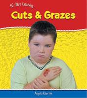 Cuts and Grazes