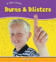 Burns and Blisters