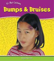 Bumps and Bruises