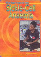 What Does It Mean to Have Sickle-Cell Anaemia