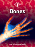 Bones