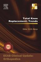 Total Knee Replacement