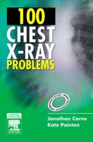 100 Chest X-Ray Problems